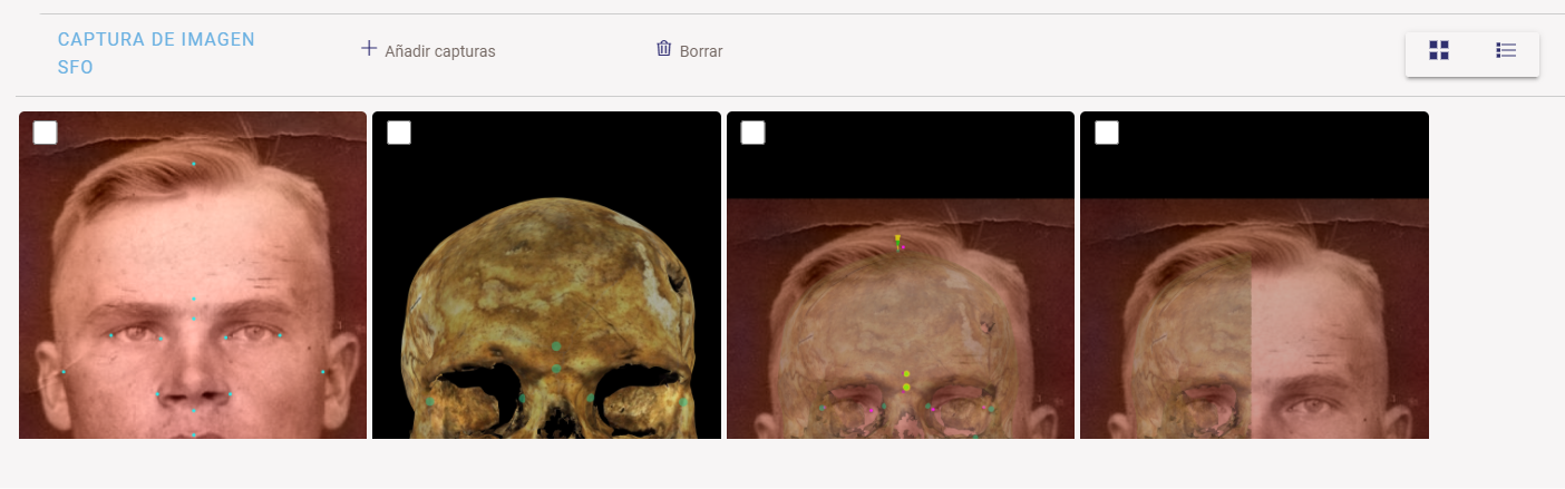 Capturas de pantalla añadidas referentes a los puntos cefalométricos, craneométricos y el solapamiento cráneo-cara